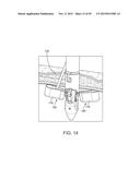 NEEDLE AND SNARE GUIDE APPARATUS FOR PASSING SUTURE diagram and image