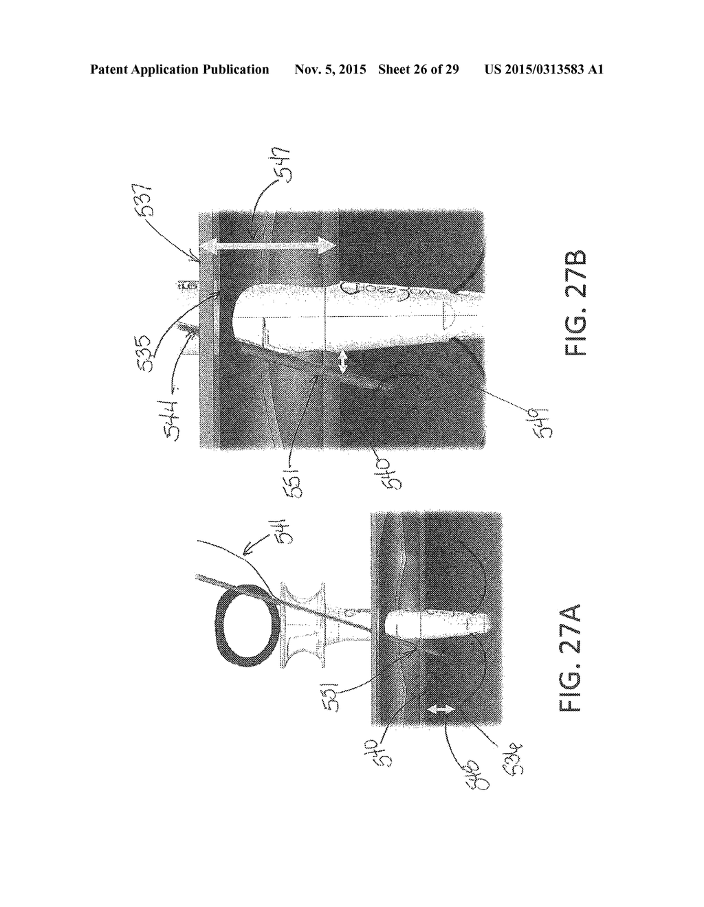 NEEDLE AND SNARE GUIDE APPARATUS FOR PASSING SUTURE - diagram, schematic, and image 27