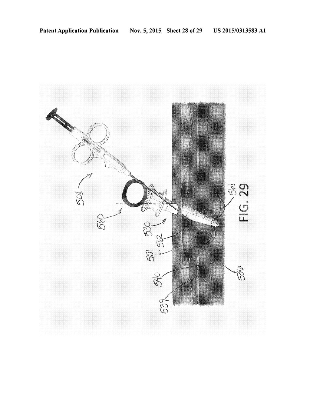 NEEDLE AND SNARE GUIDE APPARATUS FOR PASSING SUTURE - diagram, schematic, and image 29