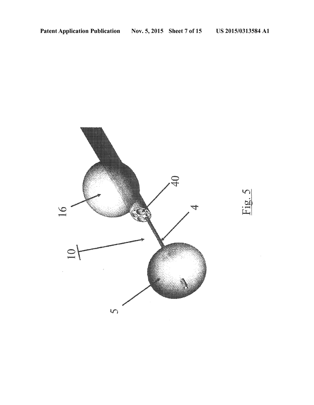 SUSTANTIALLY RIGID AND STABLE ENDOLUMINAL SURGICAL SUITE FOR TREATING A     GASTROINTESTINAL LESION - diagram, schematic, and image 08