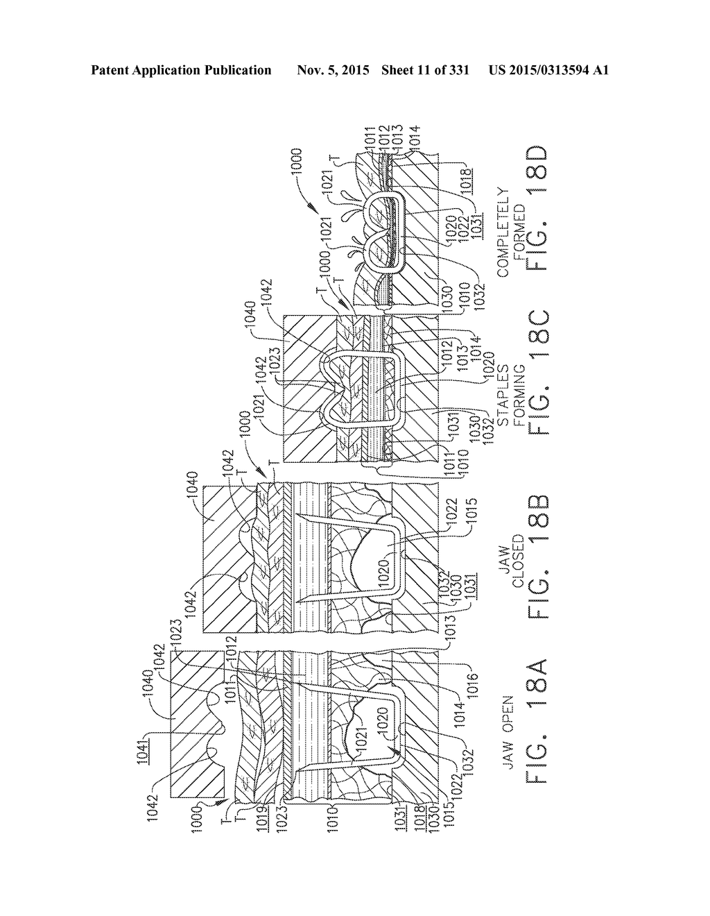 RETAINER ASSEMBLY INCLUDING A TISSUE THICKNESS COMPENSATOR - diagram, schematic, and image 12