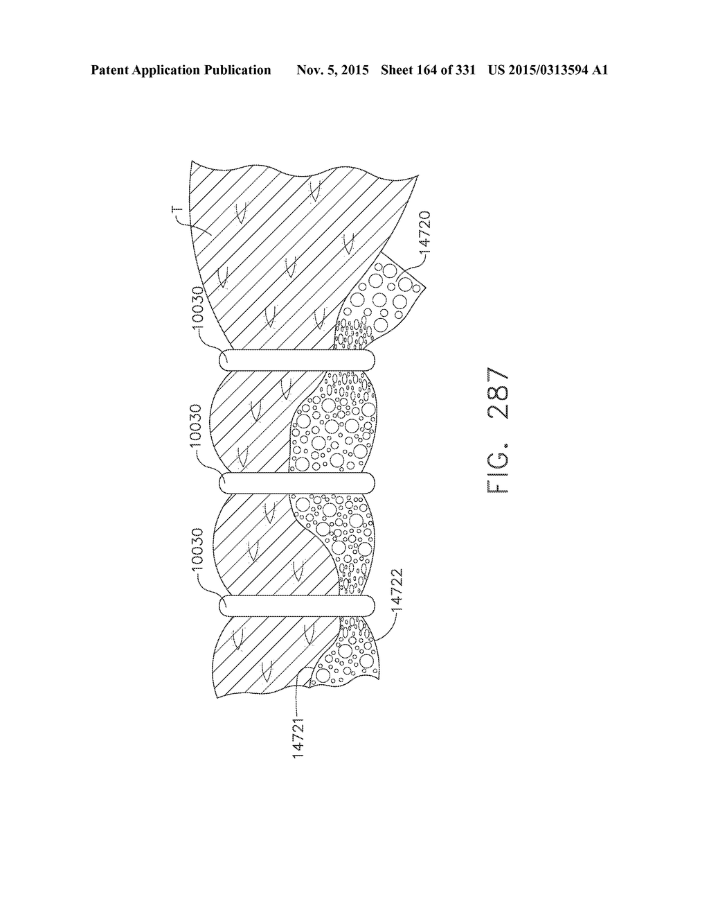 RETAINER ASSEMBLY INCLUDING A TISSUE THICKNESS COMPENSATOR - diagram, schematic, and image 165