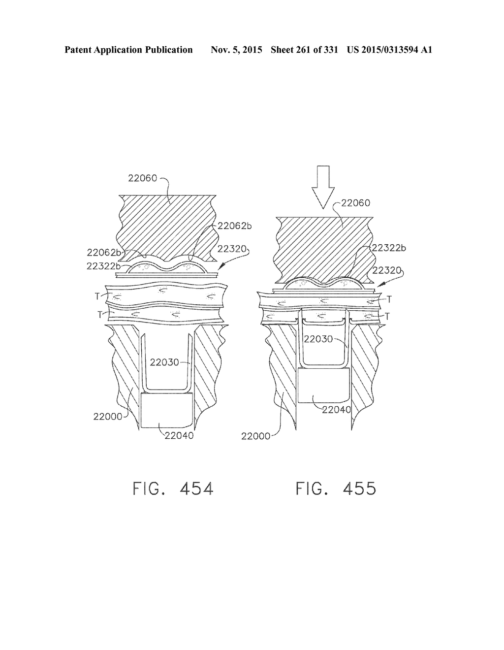 RETAINER ASSEMBLY INCLUDING A TISSUE THICKNESS COMPENSATOR - diagram, schematic, and image 262