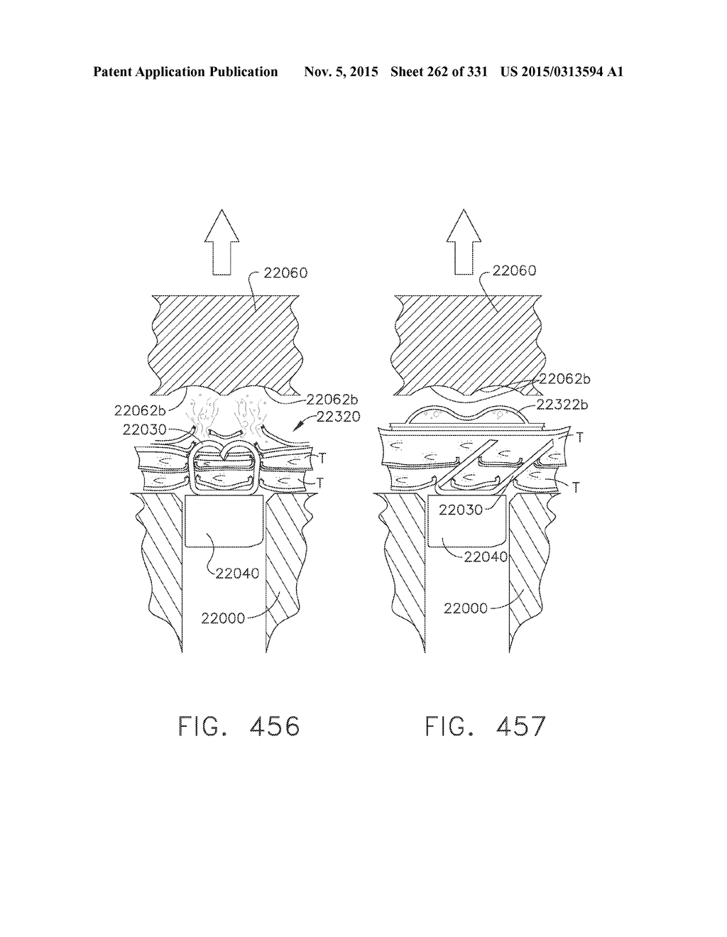 RETAINER ASSEMBLY INCLUDING A TISSUE THICKNESS COMPENSATOR - diagram, schematic, and image 263