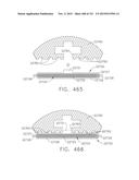 RETAINER ASSEMBLY INCLUDING A TISSUE THICKNESS COMPENSATOR diagram and image