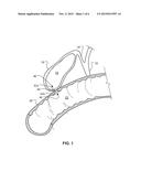 Anastomosis Devices diagram and image