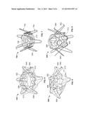 Anastomosis Devices diagram and image