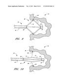 METHOD OF CLOSING AN OPENING IN A WALL OF THE HEART diagram and image