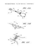 METHOD OF CLOSING AN OPENING IN A WALL OF THE HEART diagram and image