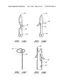 METHOD OF CLOSING AN OPENING IN A WALL OF THE HEART diagram and image