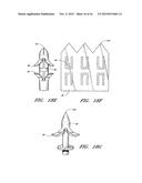 METHOD OF CLOSING AN OPENING IN A WALL OF THE HEART diagram and image