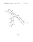 NONINVASIVE PROTECTION FROM EMBOLI diagram and image