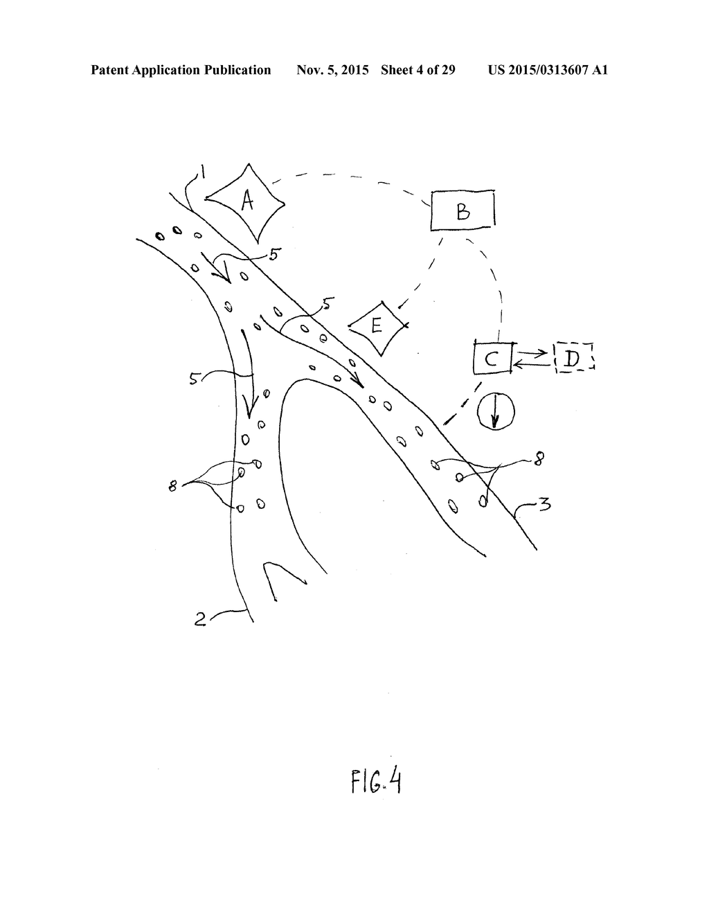 NONINVASIVE PROTECTION FROM EMBOLI - diagram, schematic, and image 05