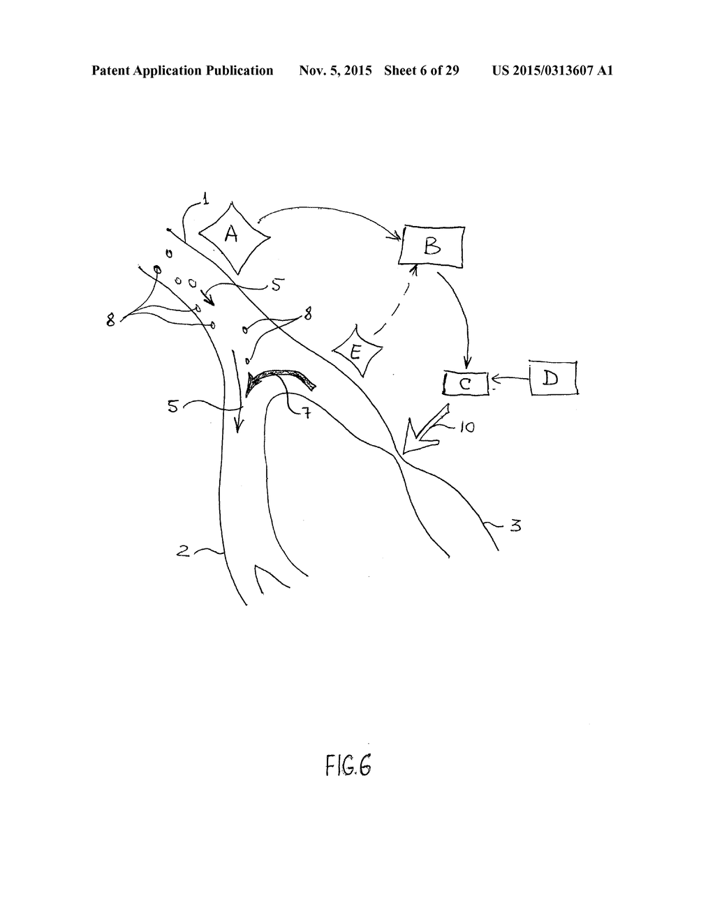 NONINVASIVE PROTECTION FROM EMBOLI - diagram, schematic, and image 07