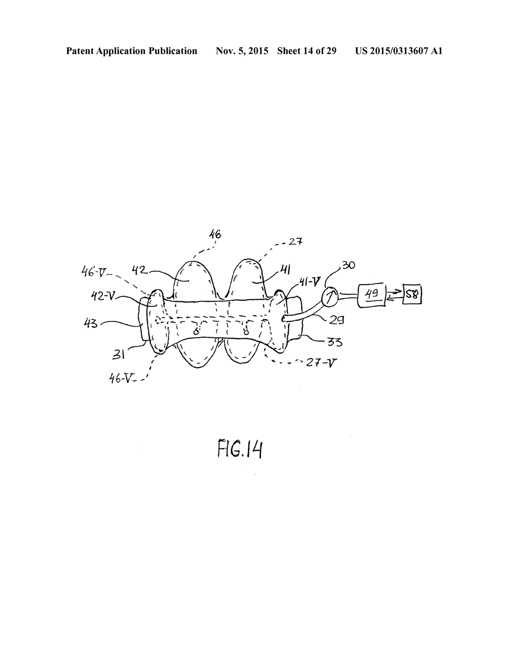 NONINVASIVE PROTECTION FROM EMBOLI - diagram, schematic, and image 15