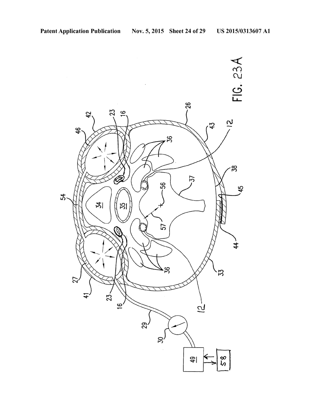 NONINVASIVE PROTECTION FROM EMBOLI - diagram, schematic, and image 25