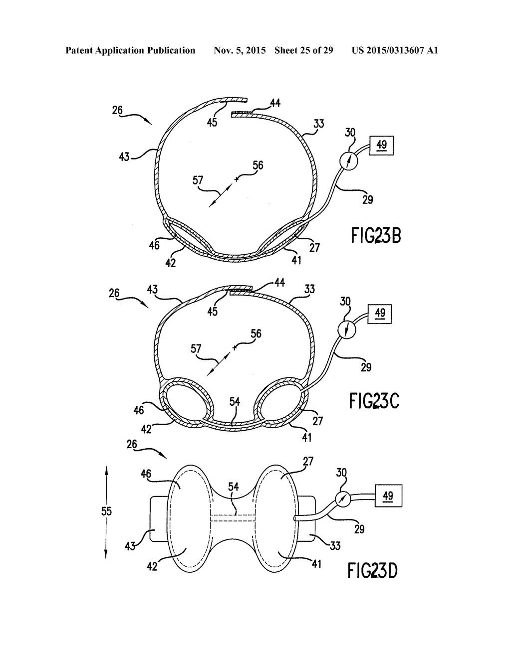 NONINVASIVE PROTECTION FROM EMBOLI - diagram, schematic, and image 26