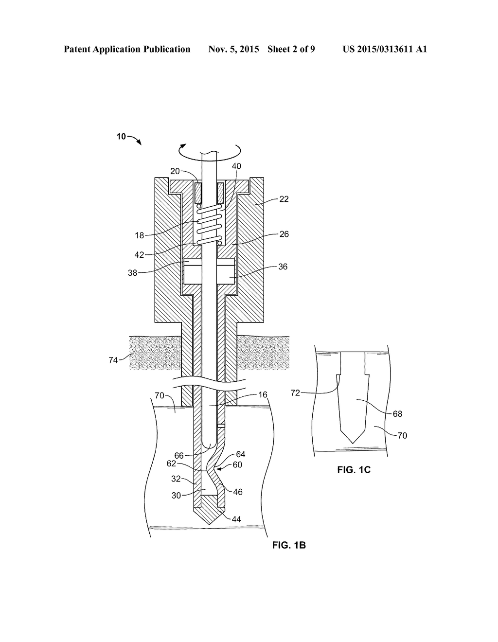 UNDERCUTTING BONE DRILLS AND METHODS OF USE - diagram, schematic, and image 03