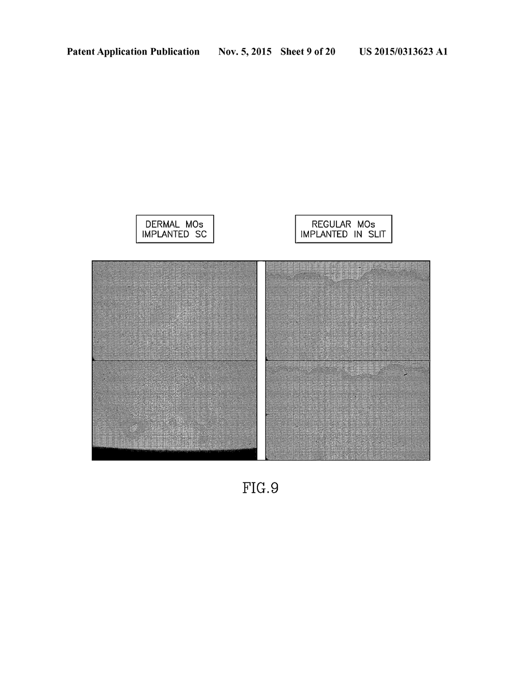 DERMAL MICRO-ORGANS, METHODS AND APPARATUSES FOR PRODUCING AND USING THE     SAME - diagram, schematic, and image 10