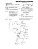 AORTIC DISSECTION SEPTAL CUTTING TOOL diagram and image