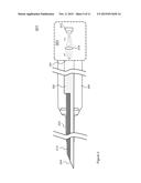 Solid Introducer Needle for Catheter diagram and image