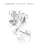 PERICARDIAL ACCESS DEVICE diagram and image