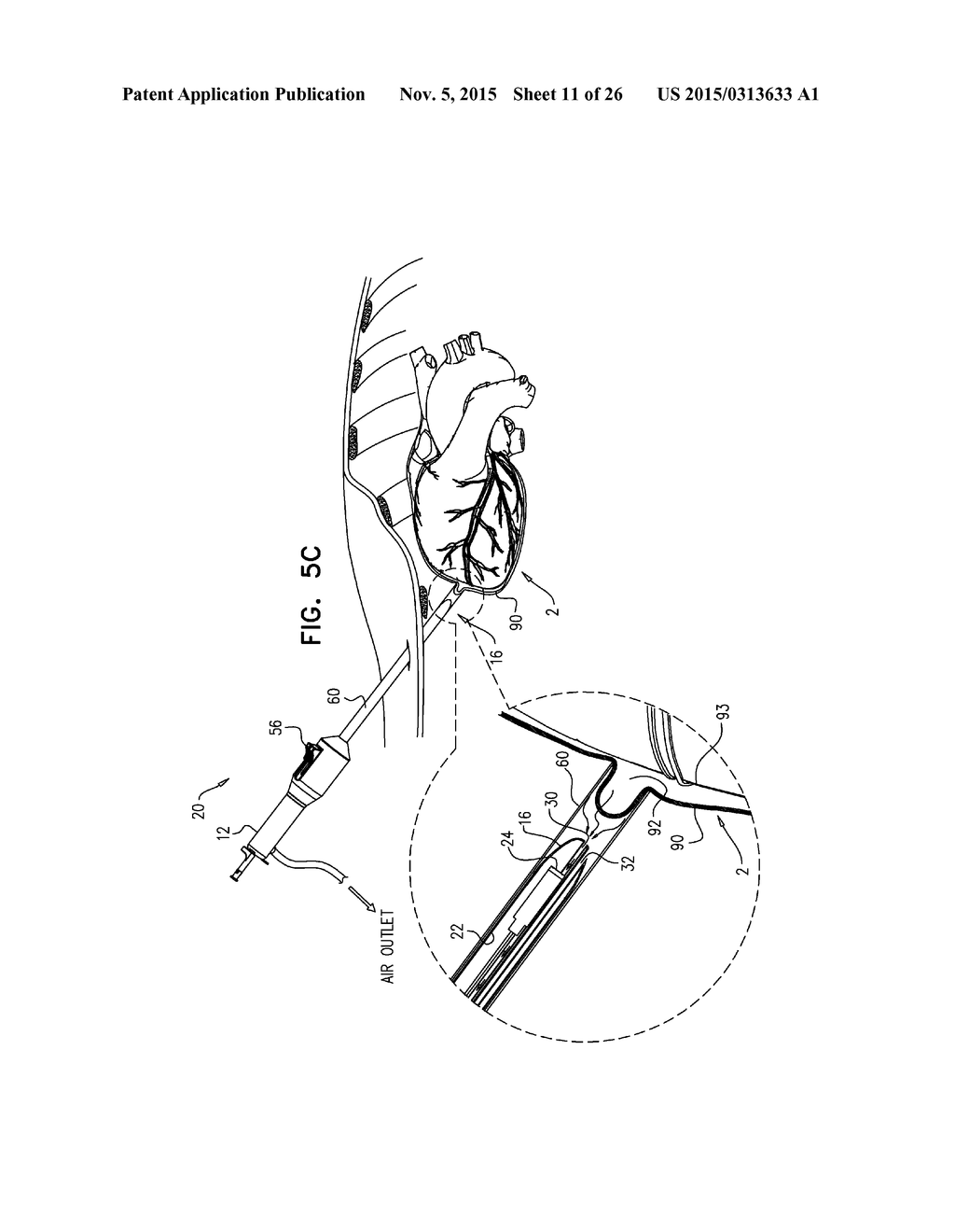 PERICARDIAL ACCESS DEVICE - diagram, schematic, and image 12