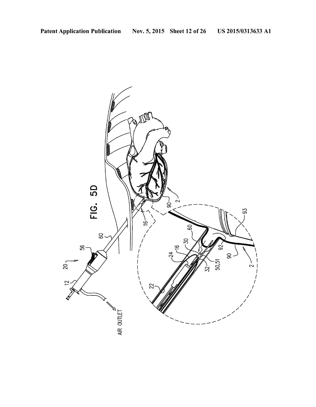 PERICARDIAL ACCESS DEVICE - diagram, schematic, and image 13