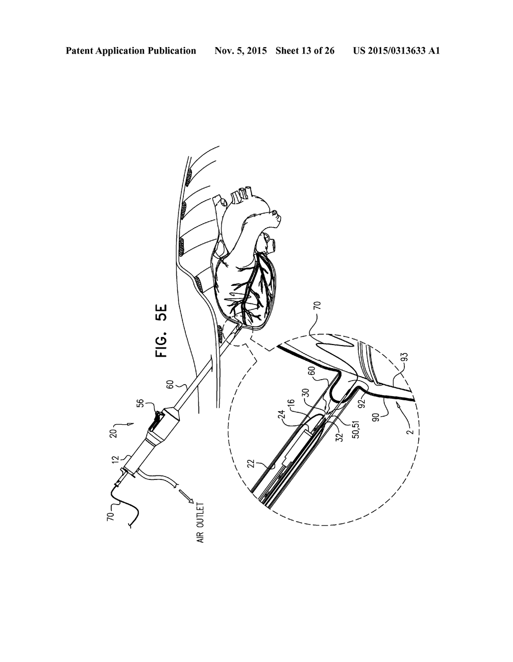 PERICARDIAL ACCESS DEVICE - diagram, schematic, and image 14