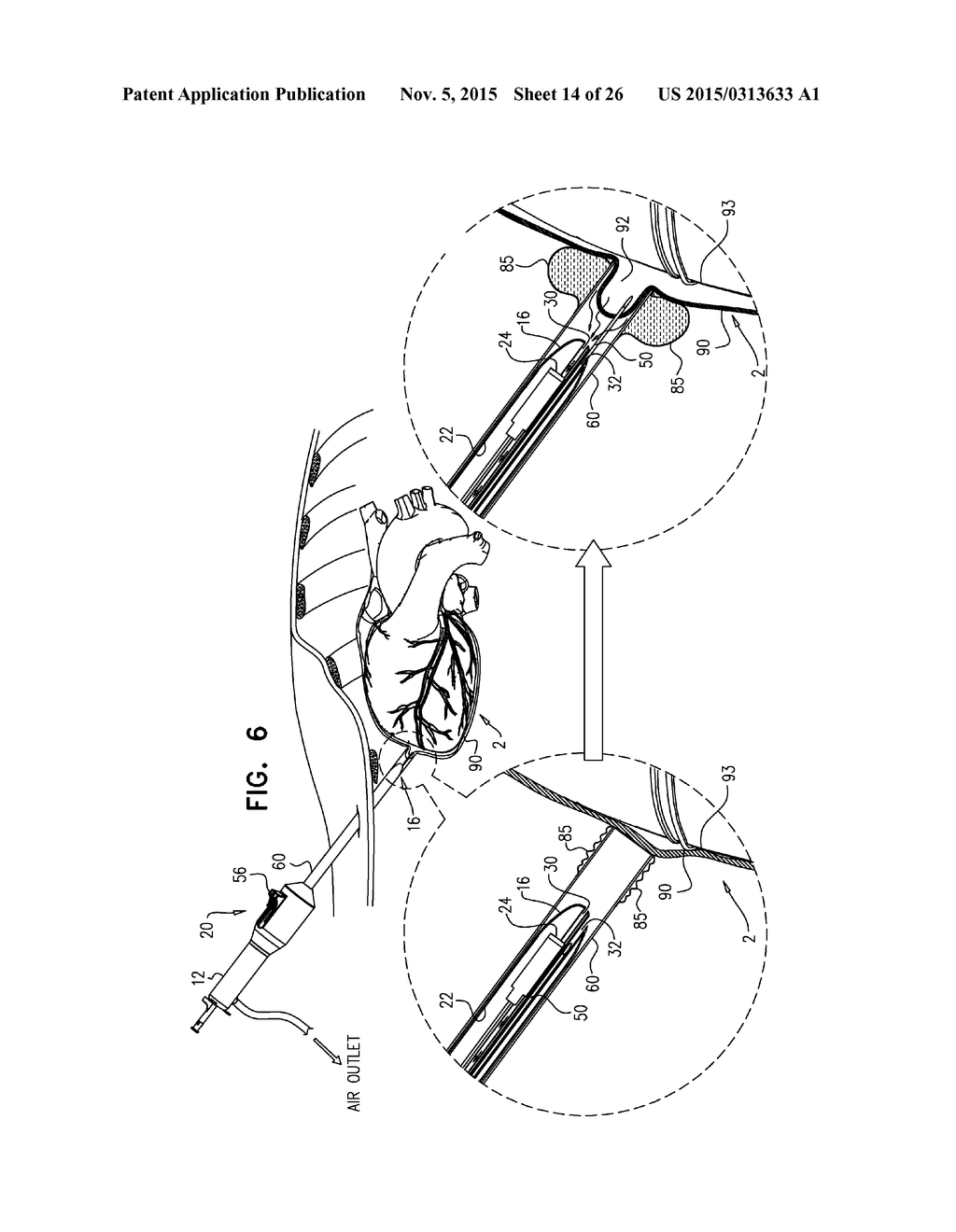 PERICARDIAL ACCESS DEVICE - diagram, schematic, and image 15