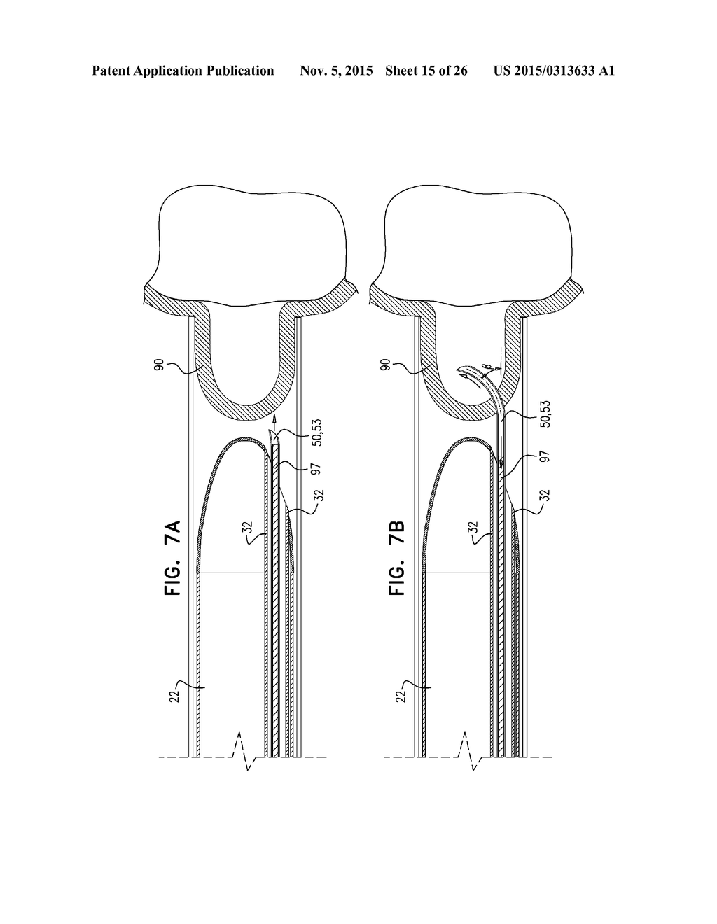 PERICARDIAL ACCESS DEVICE - diagram, schematic, and image 16