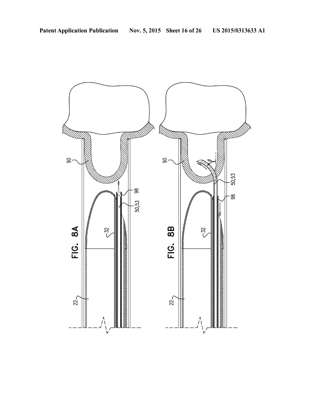 PERICARDIAL ACCESS DEVICE - diagram, schematic, and image 17