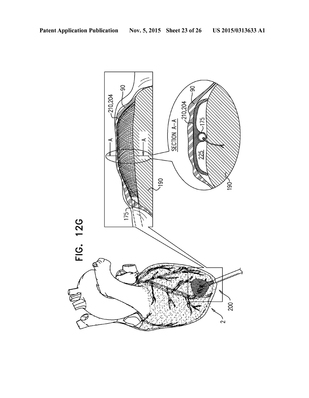 PERICARDIAL ACCESS DEVICE - diagram, schematic, and image 24