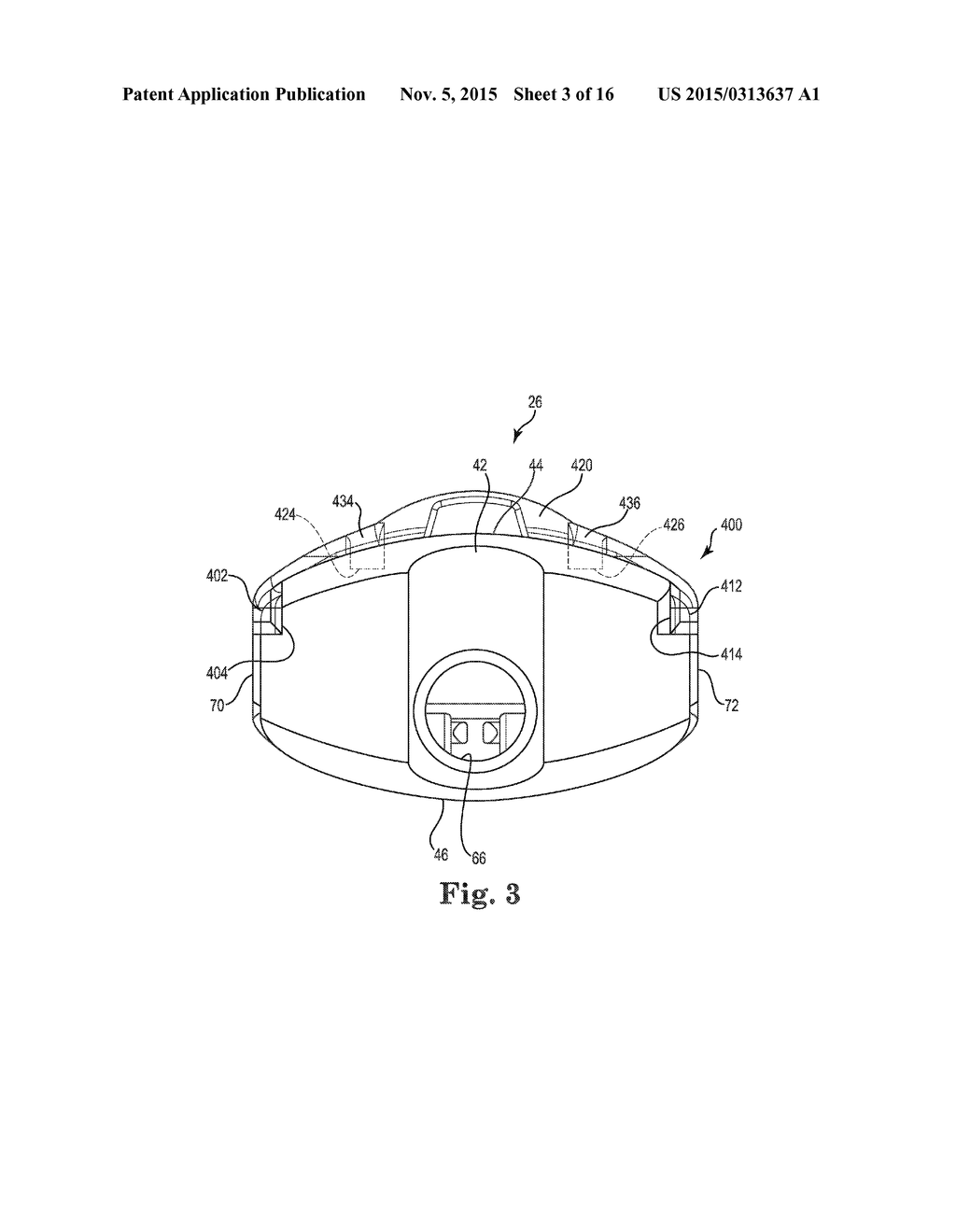 VAGINAL MANIPULATOR WITH A HEAD EXTENDER - diagram, schematic, and image 04