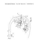 VAGINAL MANIPULATOR WITH A HEAD EXTENDER diagram and image