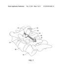 MINIMALLY INVASIVE SPINAL COLUMN REALIGNMENT SYSTEM AND METHOD diagram and image