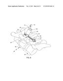 MINIMALLY INVASIVE SPINAL COLUMN REALIGNMENT SYSTEM AND METHOD diagram and image