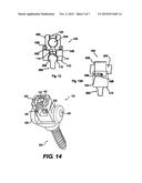 CONFORMING BONE STABILIZATION RECEIVER diagram and image