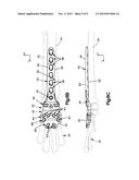 Pancarpal Arthrodesis Bone Plate diagram and image