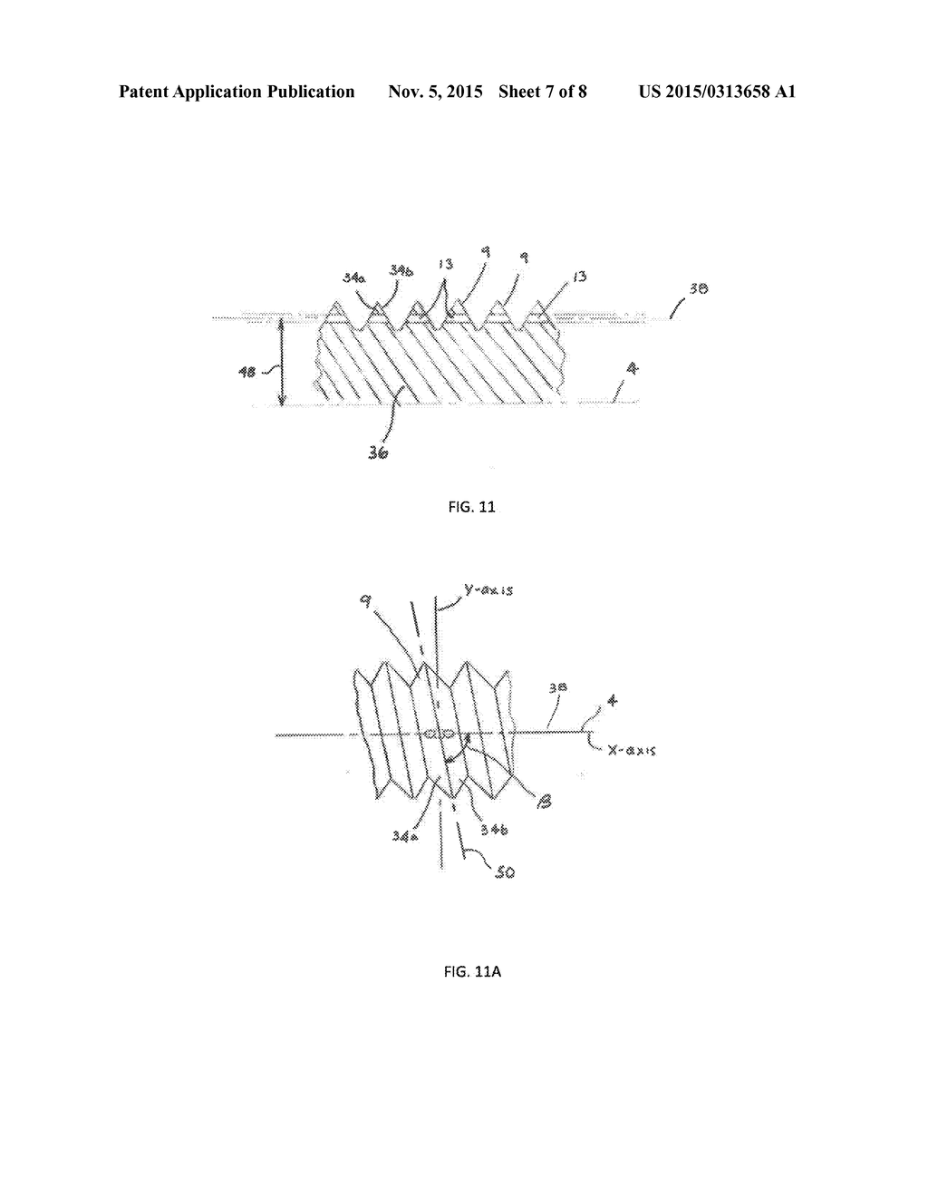 BONE SCREW WITH APERTURES - diagram, schematic, and image 08