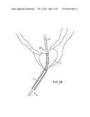 TISSUE RESECTION AND TREATMENT WITH SHEDDING PULSES diagram and image