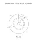 TISSUE RESECTION AND TREATMENT WITH SHEDDING PULSES diagram and image