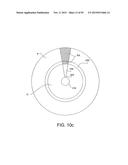 TISSUE RESECTION AND TREATMENT WITH SHEDDING PULSES diagram and image