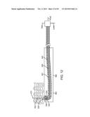 TISSUE RESECTION AND TREATMENT WITH SHEDDING PULSES diagram and image