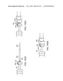 TISSUE RESECTION AND TREATMENT WITH SHEDDING PULSES diagram and image