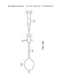 TISSUE RESECTION AND TREATMENT WITH SHEDDING PULSES diagram and image