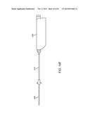 TISSUE RESECTION AND TREATMENT WITH SHEDDING PULSES diagram and image