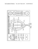 TISSUE RESECTION AND TREATMENT WITH SHEDDING PULSES diagram and image