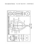 TISSUE RESECTION AND TREATMENT WITH SHEDDING PULSES diagram and image