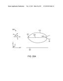 TISSUE RESECTION AND TREATMENT WITH SHEDDING PULSES diagram and image